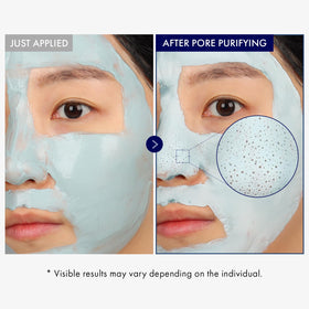 TOSOWOONG mask applied on nose illustrating targeted pore cleaning benefit