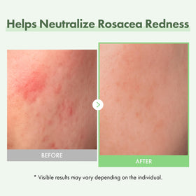 TOSOWOONG label close-up highlighting ingredients, benefits transparency and safety