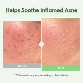 TOSOWOONG close-up of serum texture, lightweight hydrating finish benefit