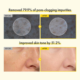 TOSOWOONG capsule detail visible to show active delivery and exfoliation