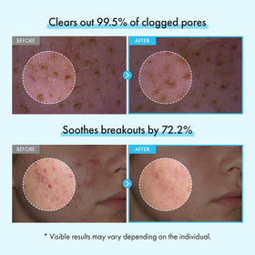 TOSOWOONG capsule foam adhering to pores to lift impurities