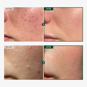 TOSOWOONG serum dropper releasing lightweight centella texture for quick absorption