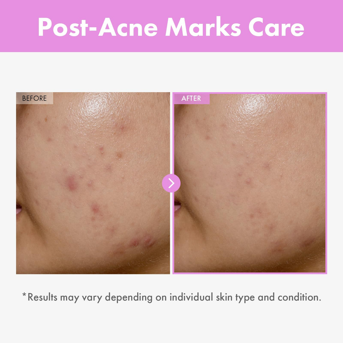 TOSOWOONG close-up label highlighting peptides and ingredient benefits