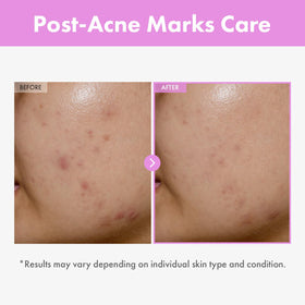 TOSOWOONG close-up label highlighting peptides and ingredient benefits
