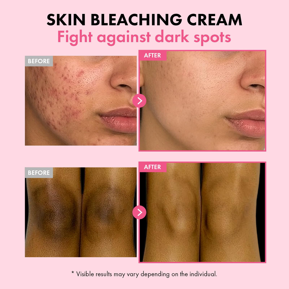 TOSOWOONG ingredients label highlighting actives like Arbutin and Niacinamide for clarity