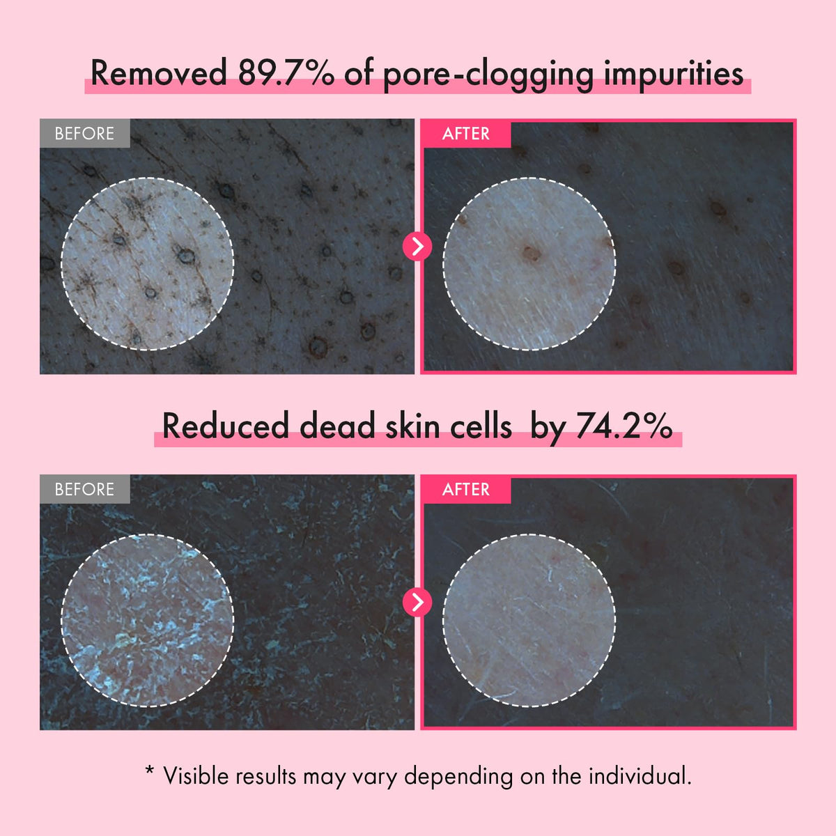 TOSOWOONG mochi-like foam in hand demonstrating gentle cleansing