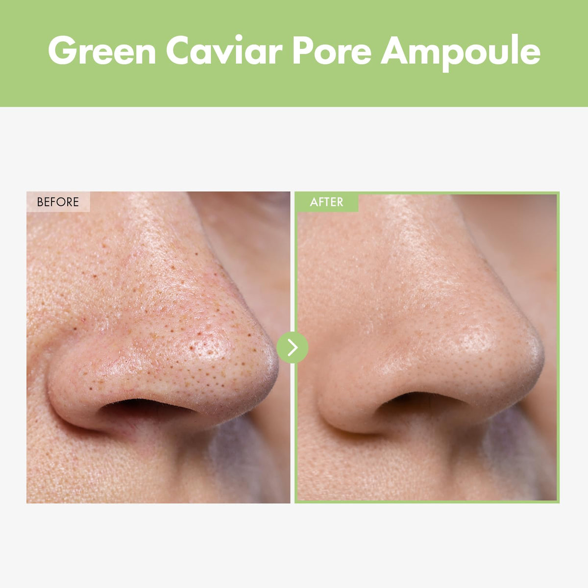 TOSOWOONG serum drop from dropper showing lightweight texture and quick absorption