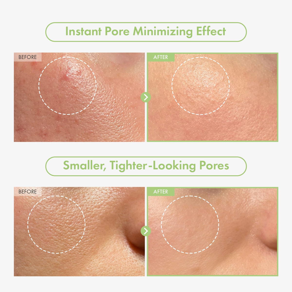 TOSOWOONG ampoule texture close-up revealing hydrating consistency for smoother skin