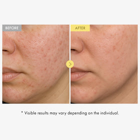 TOSOWOONG closeup of serum texture showing hydration and non-greasy finish benefit