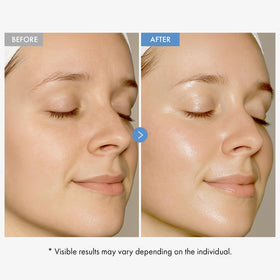 TOSOWOONG ingredient label detail with hyaluronic acid and niacinamide visible to indicate active benefits