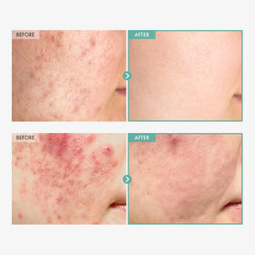 TOSOWOONG ingredient label highlighting panthenol and centella benefits