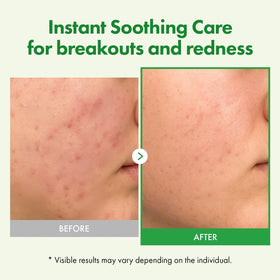 TOSOWOONG label highlighting active centella and ceramide benefits