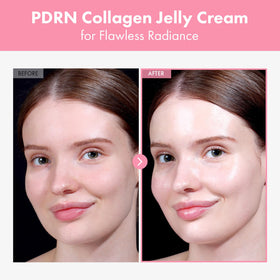 TOSOWOONG ingredient layout featuring salmon PDRN and collagen for brightening