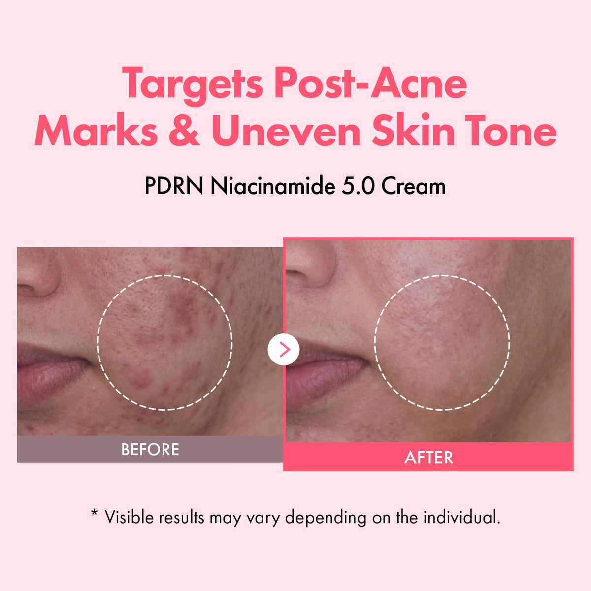 TOSOWOONG cream texture close-up showing lightweight hydrating finish