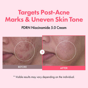TOSOWOONG cream texture close-up showing lightweight hydrating finish