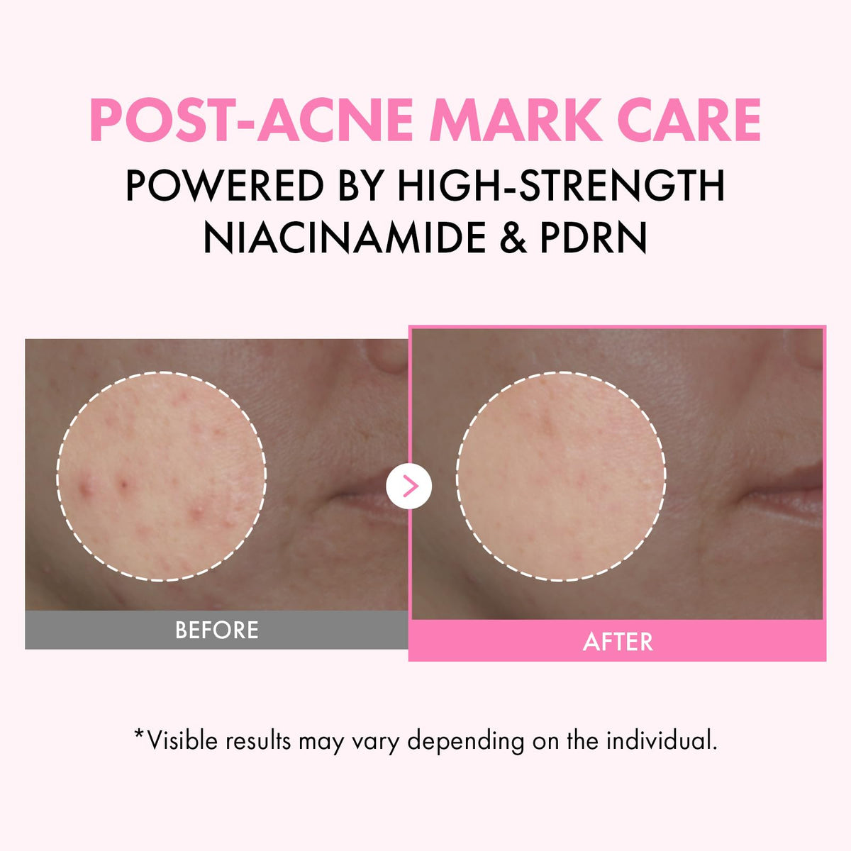 TOSOWOONG milky pink texture close-up delivering visible hydration benefit