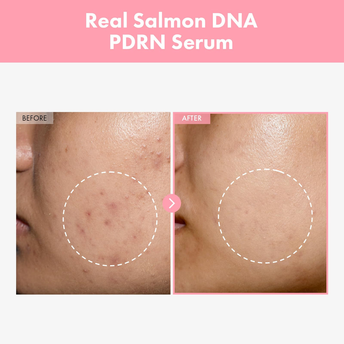 TOSOWOONG serum texture drop illustrating lightweight hydration