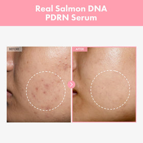 TOSOWOONG serum texture drop illustrating lightweight hydration