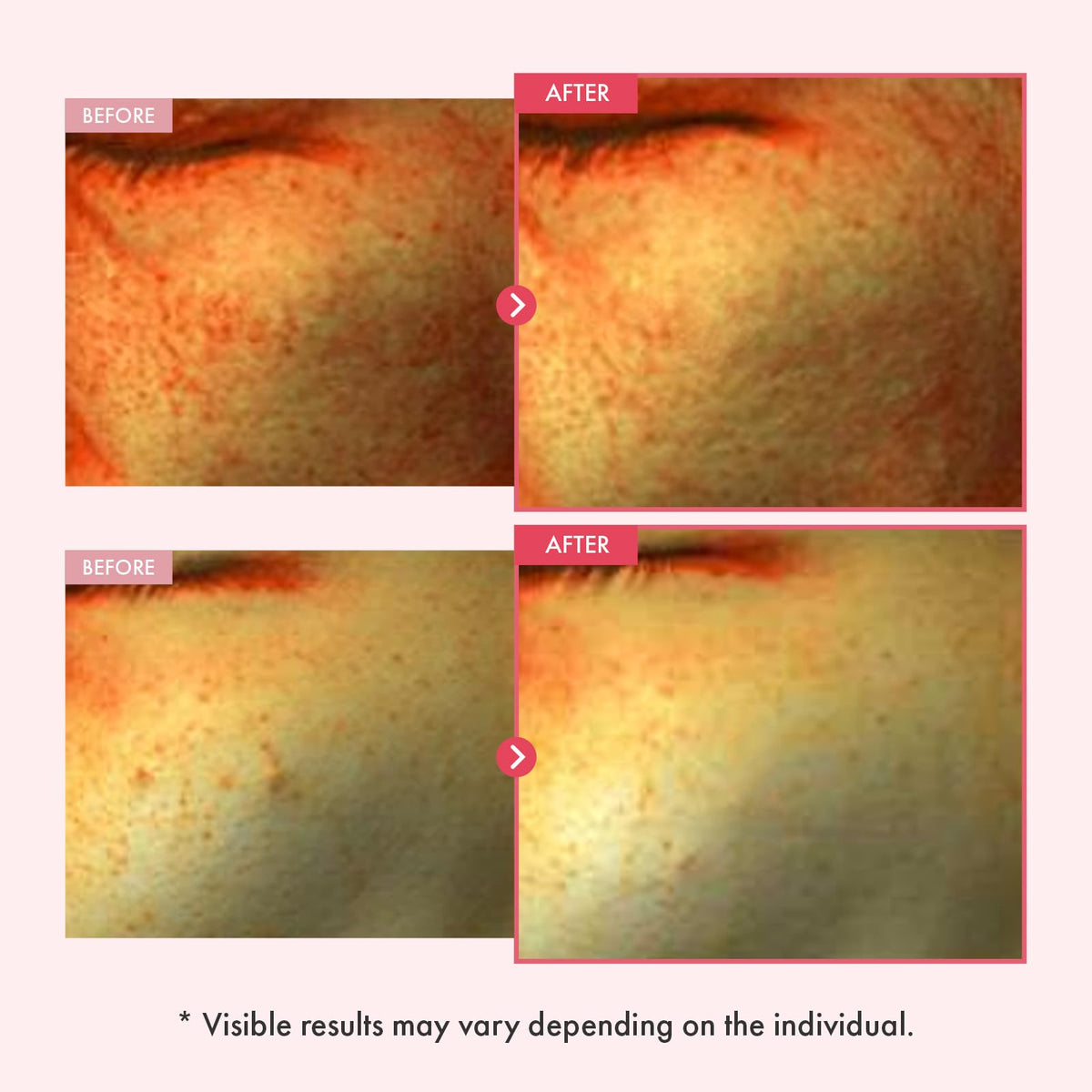 TOSOWOONG pink serum close-up in dish, highlights glow-boosting vitamin-rich formula