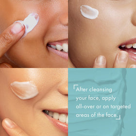 TOSOWOONG before and after scale comparison showing refined pores appearance