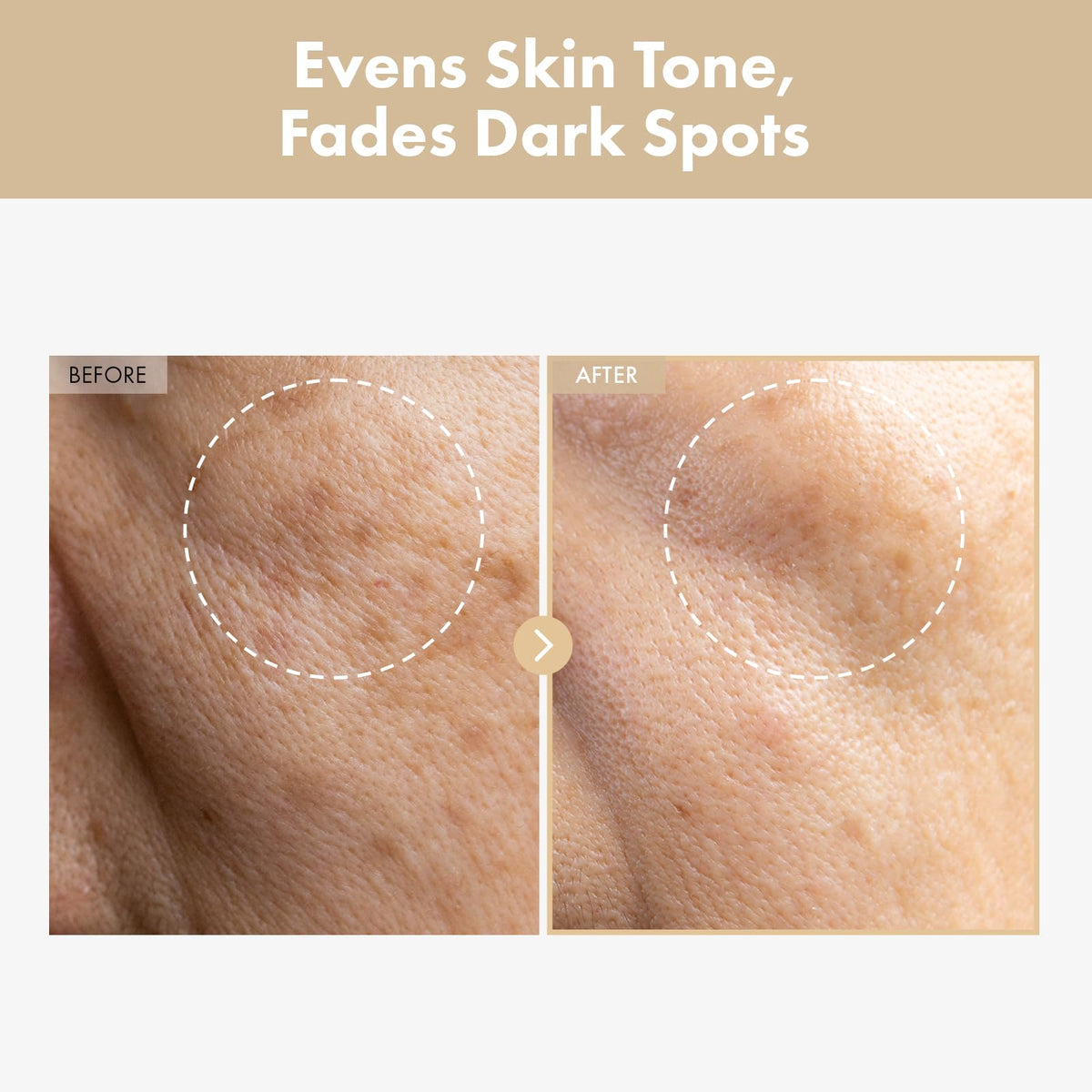 TOSOWOONG milky toner pouring texture demonstrating lightweight hydration