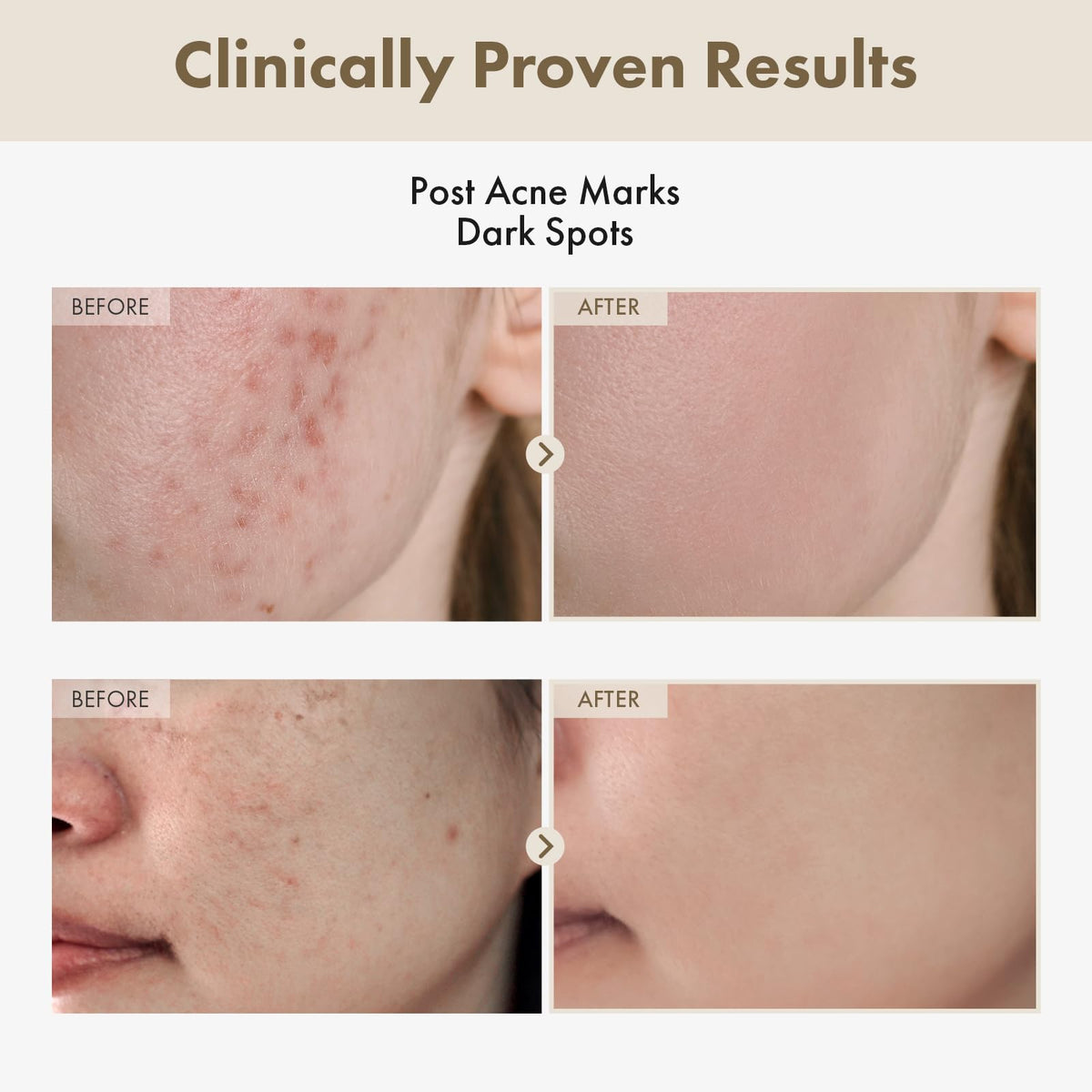 TOSOWOONG dropper dispensing clear serum, precise application for targeted treatment