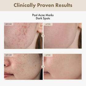 TOSOWOONG dropper dispensing clear serum, precise application for targeted treatment