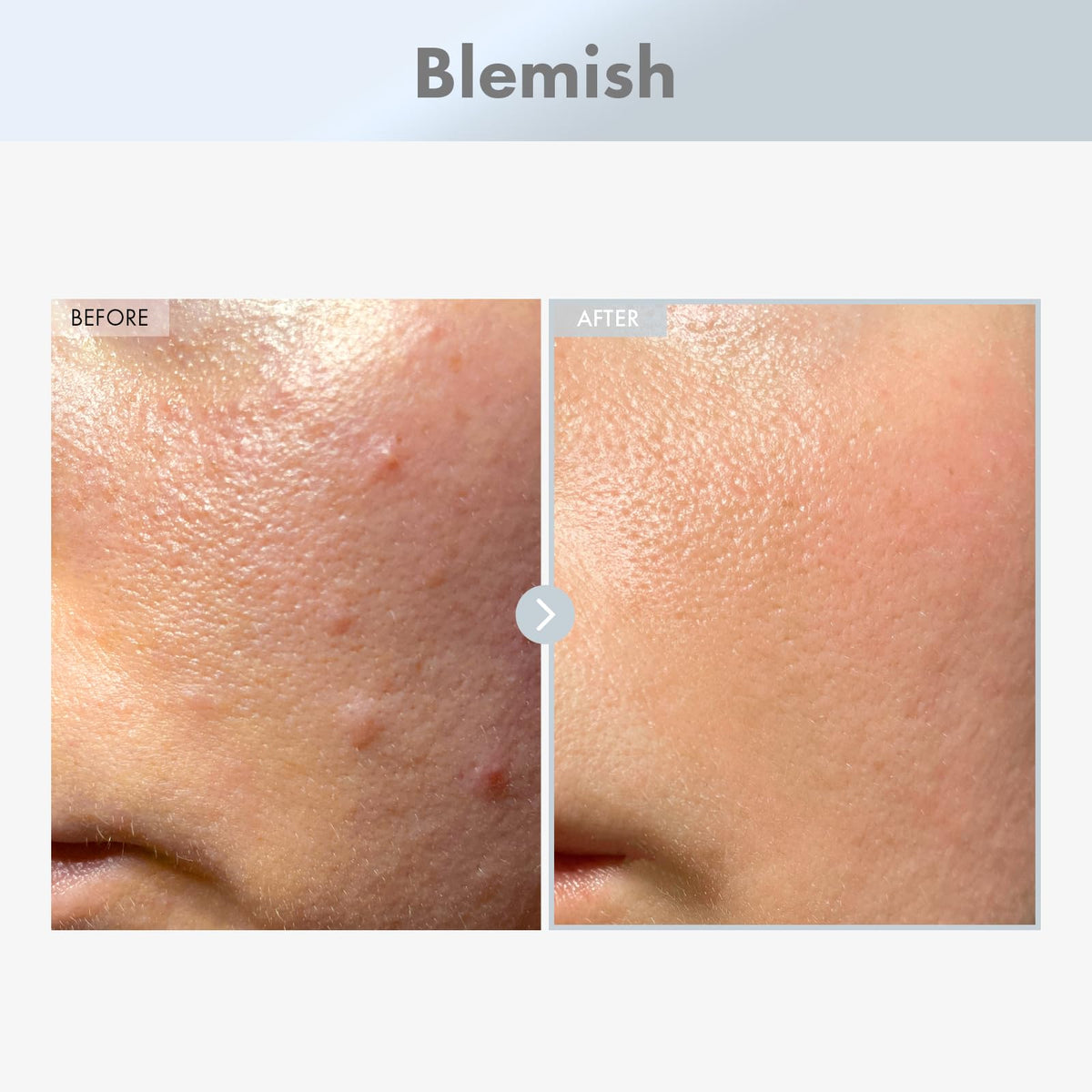 TOSOWOONG dropper dispensing serum for precise, mess-free application benefit
