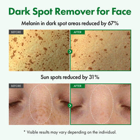 TOSOWOONG serum pipette applying drop to skin for precise brightening control