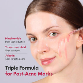 TOSOWOONG pipette dispensing serum highlighting easy controlled application
