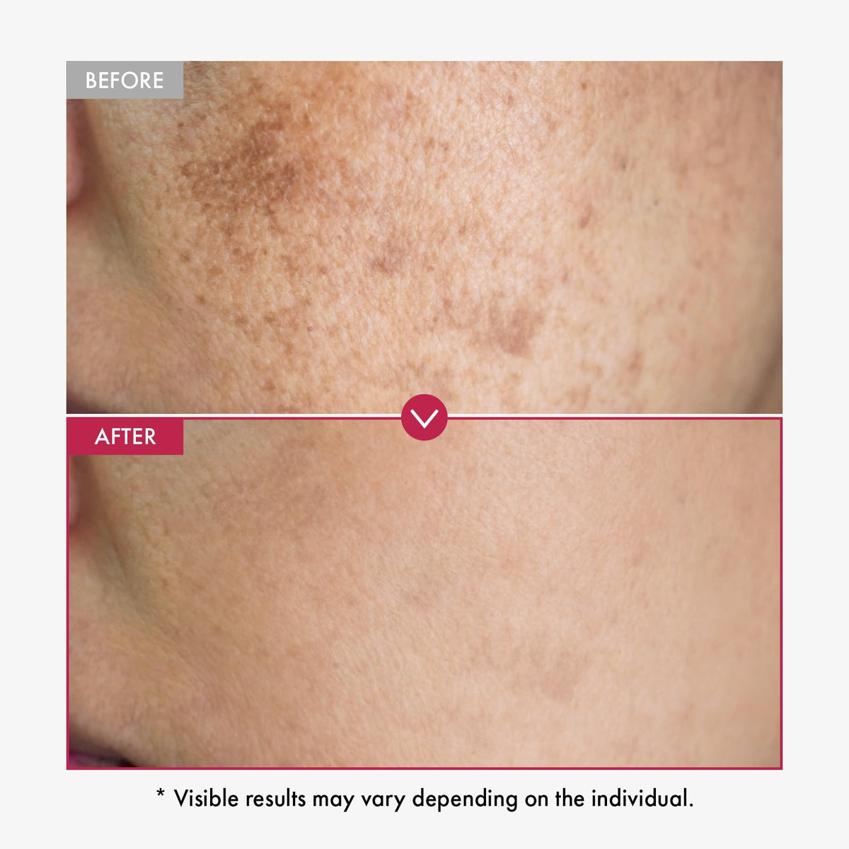 TOSOWOONG close-up of serum texture showing lightweight hydrating consistency