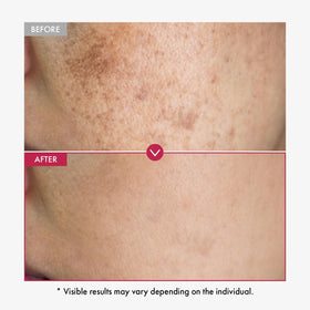 TOSOWOONG close-up of serum texture showing lightweight hydrating consistency