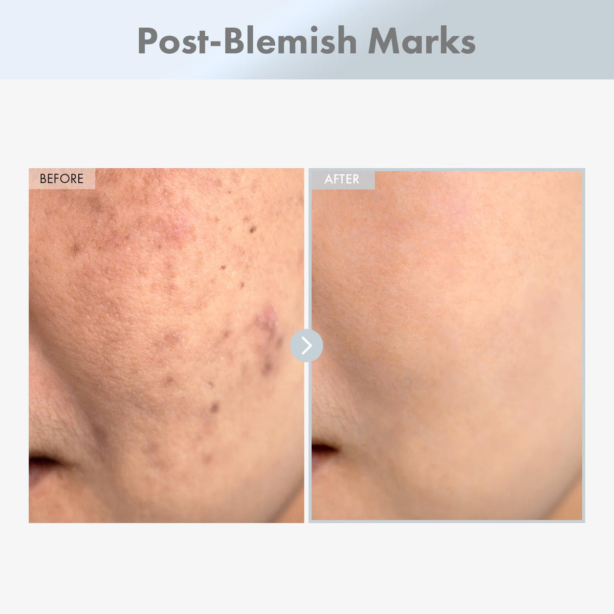TOSOWOONG close-up of serum texture highlighting lightweight absorption benefit