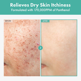 TOSOWOONG cream texture close-up demonstrating lightweight hydration