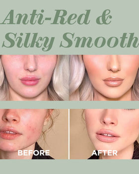 TOUCH IN SOL split-face before and after to show redness neutralizing