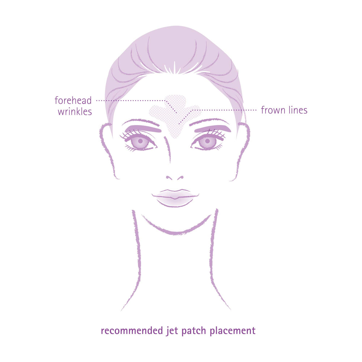 Toute Nuit patch applied on forehead demonstrating secure targeted hold