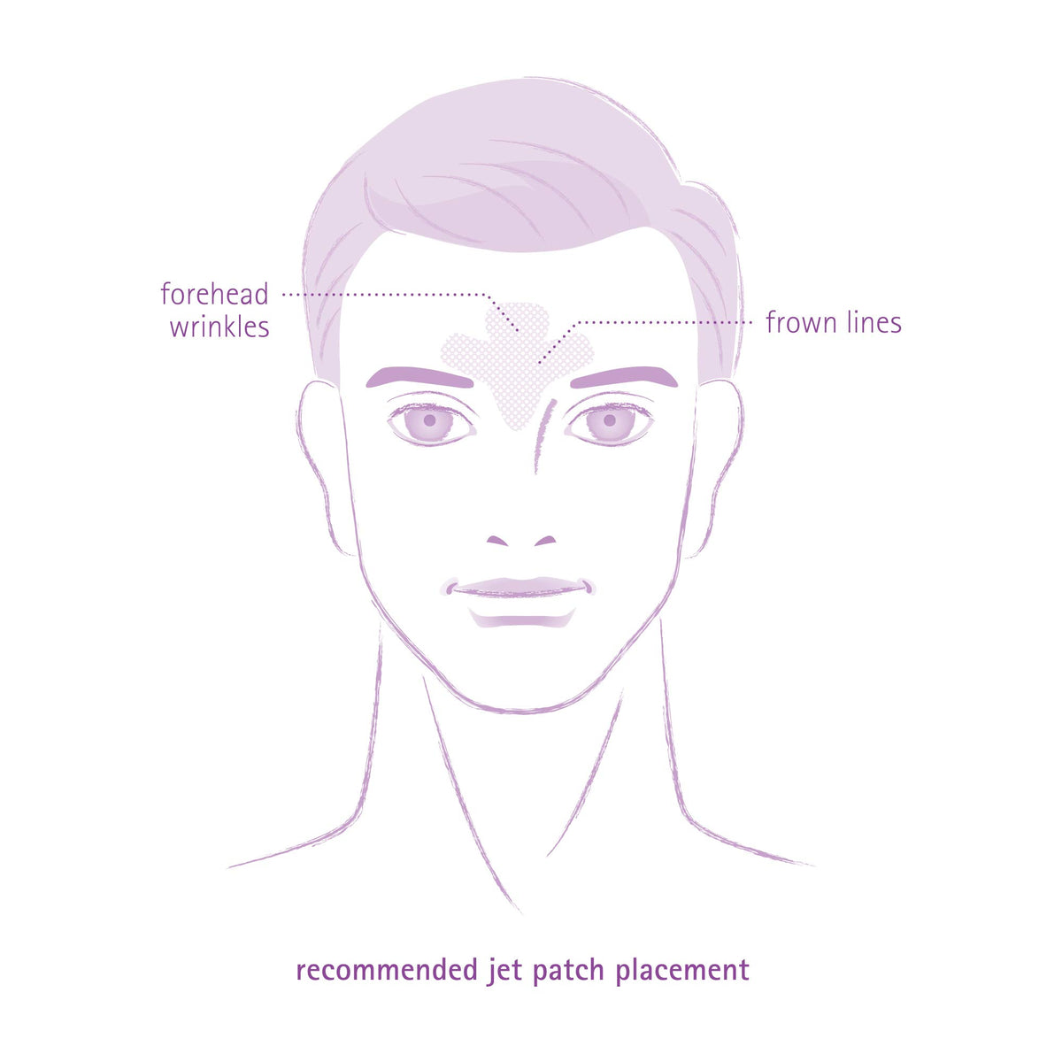 Toute Nuit patch worn while sleeping illustrating overnight wrinkle care