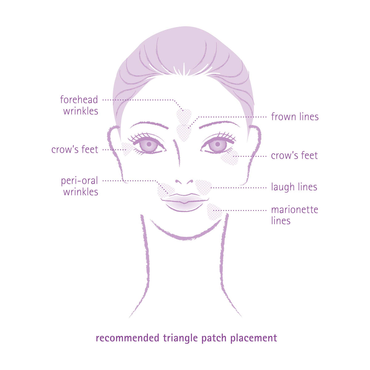 Toute Nuit patch placed at eye corner to reduce crow’s feet while discreet