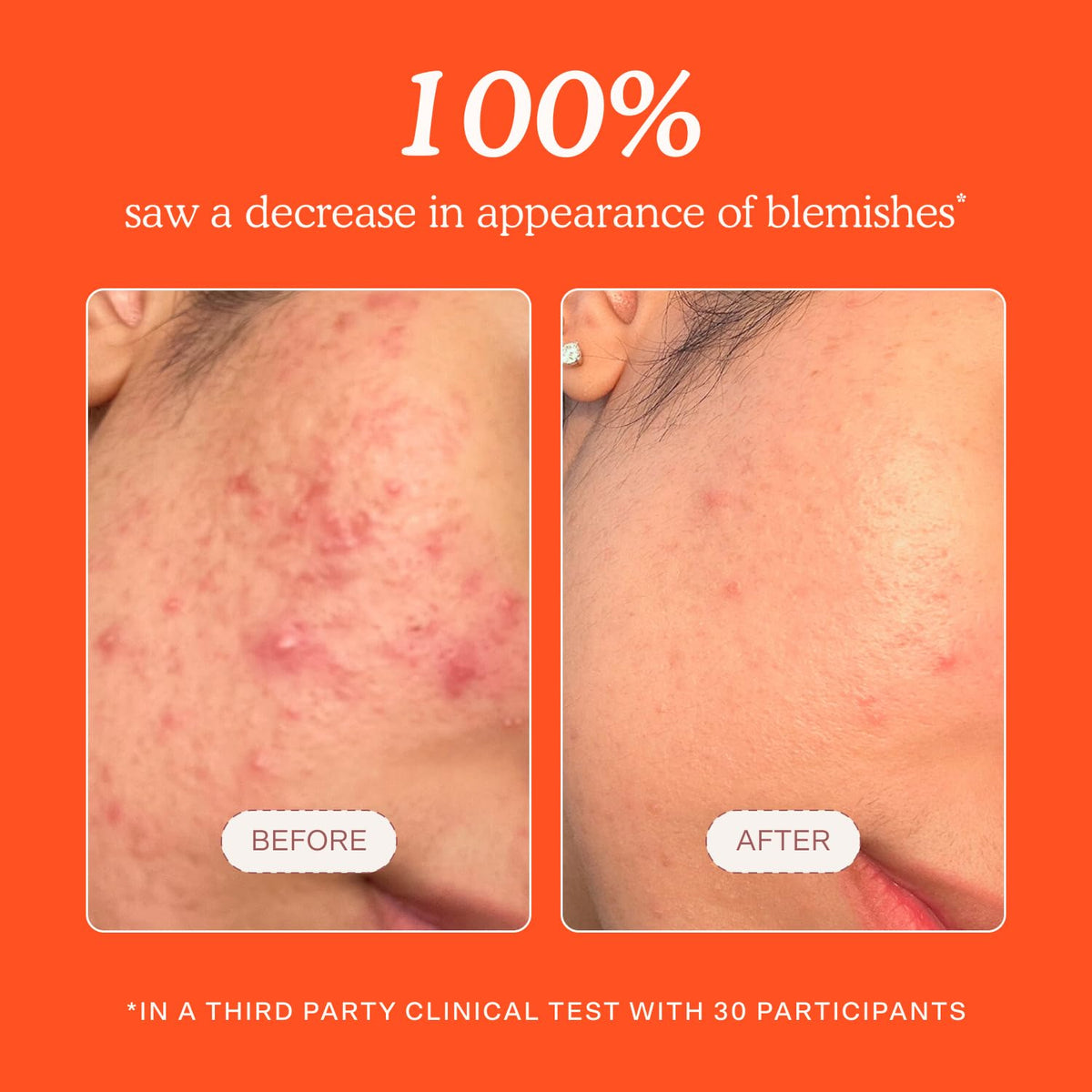 Tower 28 bottle label detail highlighting ingredients and dermatologist-tested benefit