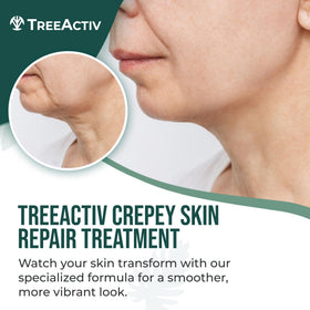 TreeActiv cream texture close‑up showing creamy consistency and rich hydration