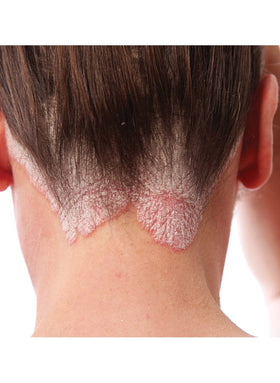 TriDerma gel texture close-up highlighting AP4 aloe and salicylic clarity benefit