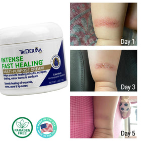 TriDerma cream on hand demonstrating quick absorption and moisturization
