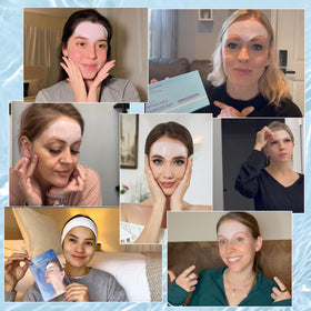 Tripsky patch applied on forehead demonstrating comfortable adhesion and smoothing