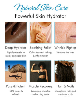 Tropical Holistic creamy emu oil texture on fingertips showing smooth spreadability