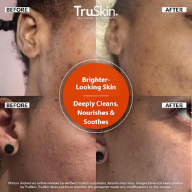 TruSkin aloe vera beside bottle conveying soothing and hydrating effects