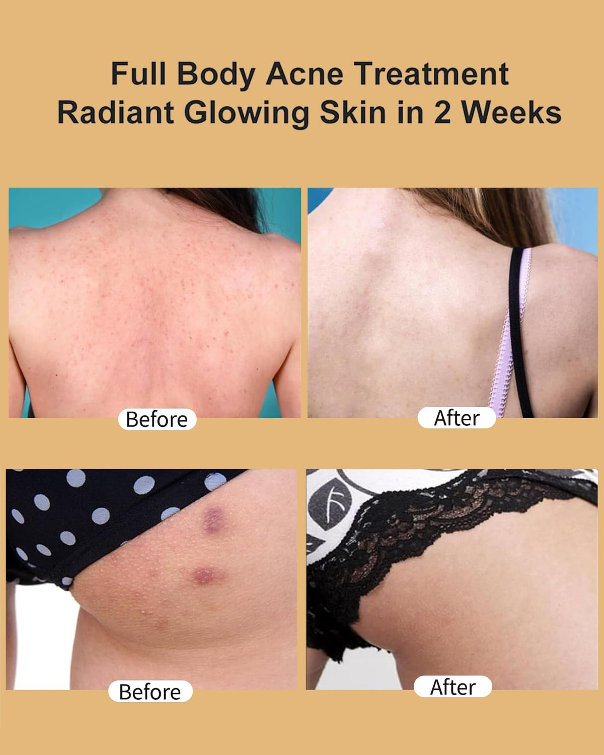 TTLALA being applied to buttocks demonstrating soothing relief and quick absorption