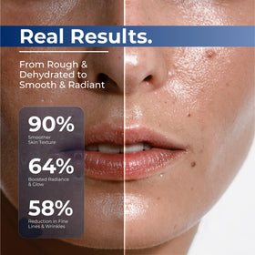 turmskin ingredient label close up highlighting 3% hyaluronic blend and formulation clarity