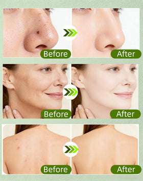 TZUNAKI ampoule next to hand showing portable size benefit