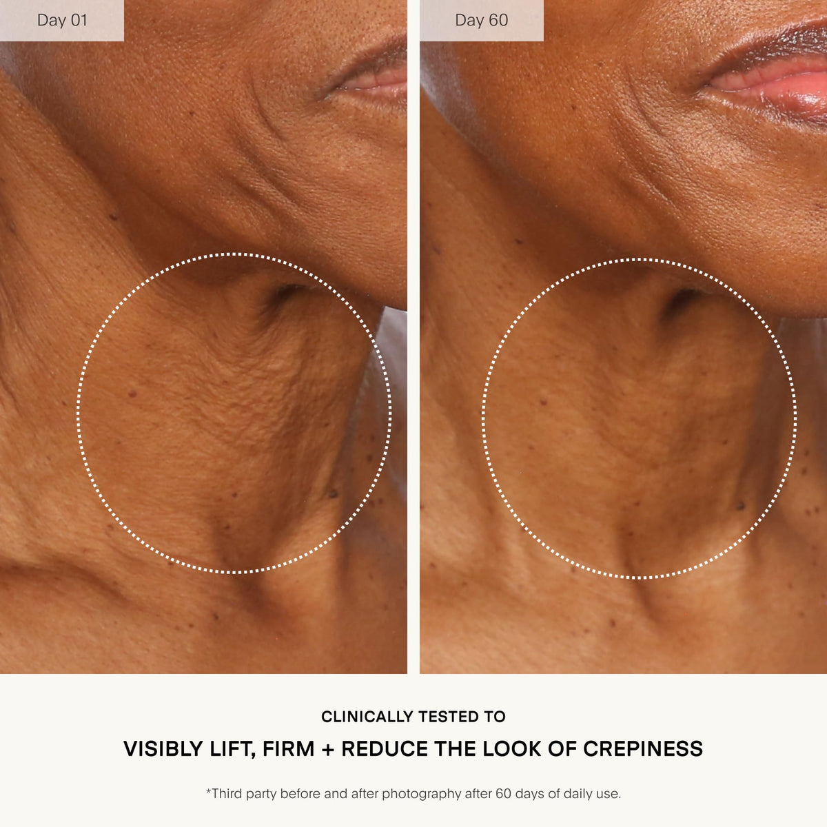 U Beauty application demo on model's neck demonstrating lifting motion