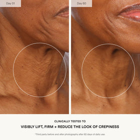 U Beauty application demo on model's neck demonstrating lifting motion